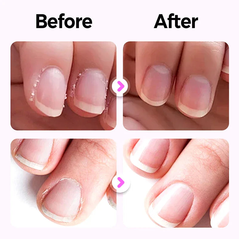 SilqueNail Pen | Transform Your Nails Into a Stunning Statement of Strength and Beauty | elesira