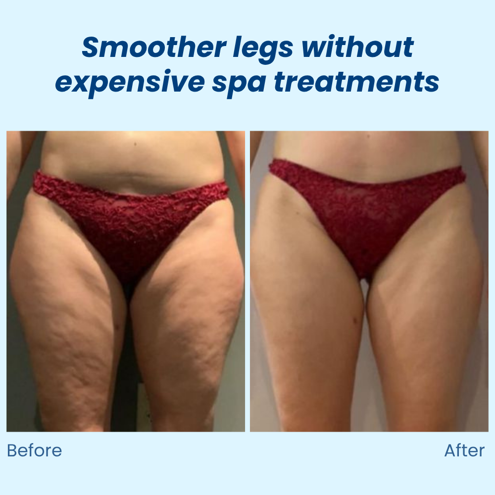 VividSculpt | Reveal Silky, Sculpted Skin That Boosts Your Confidence Every Day | elesira