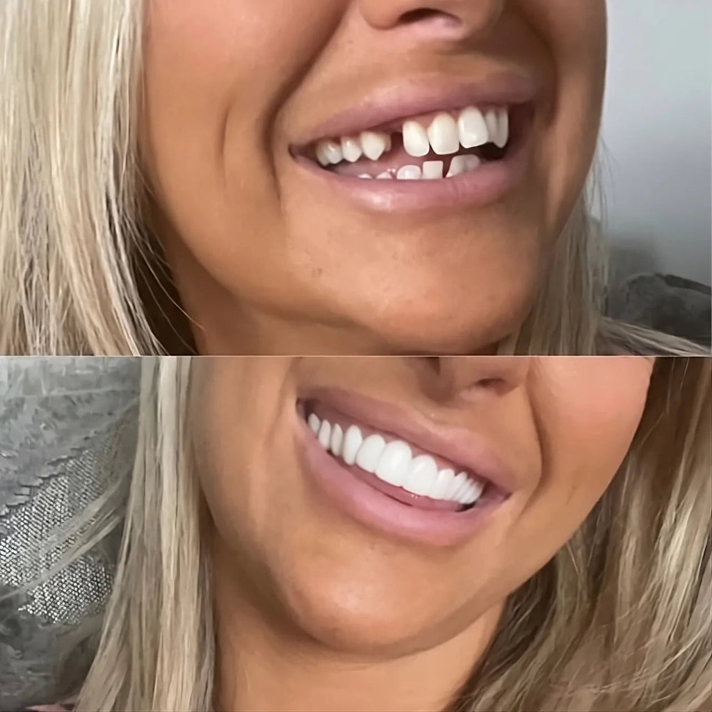 SmileLux | Sfoggia subito un sorriso abbagliante, pronto per la fotocamera, ovunque | elesira