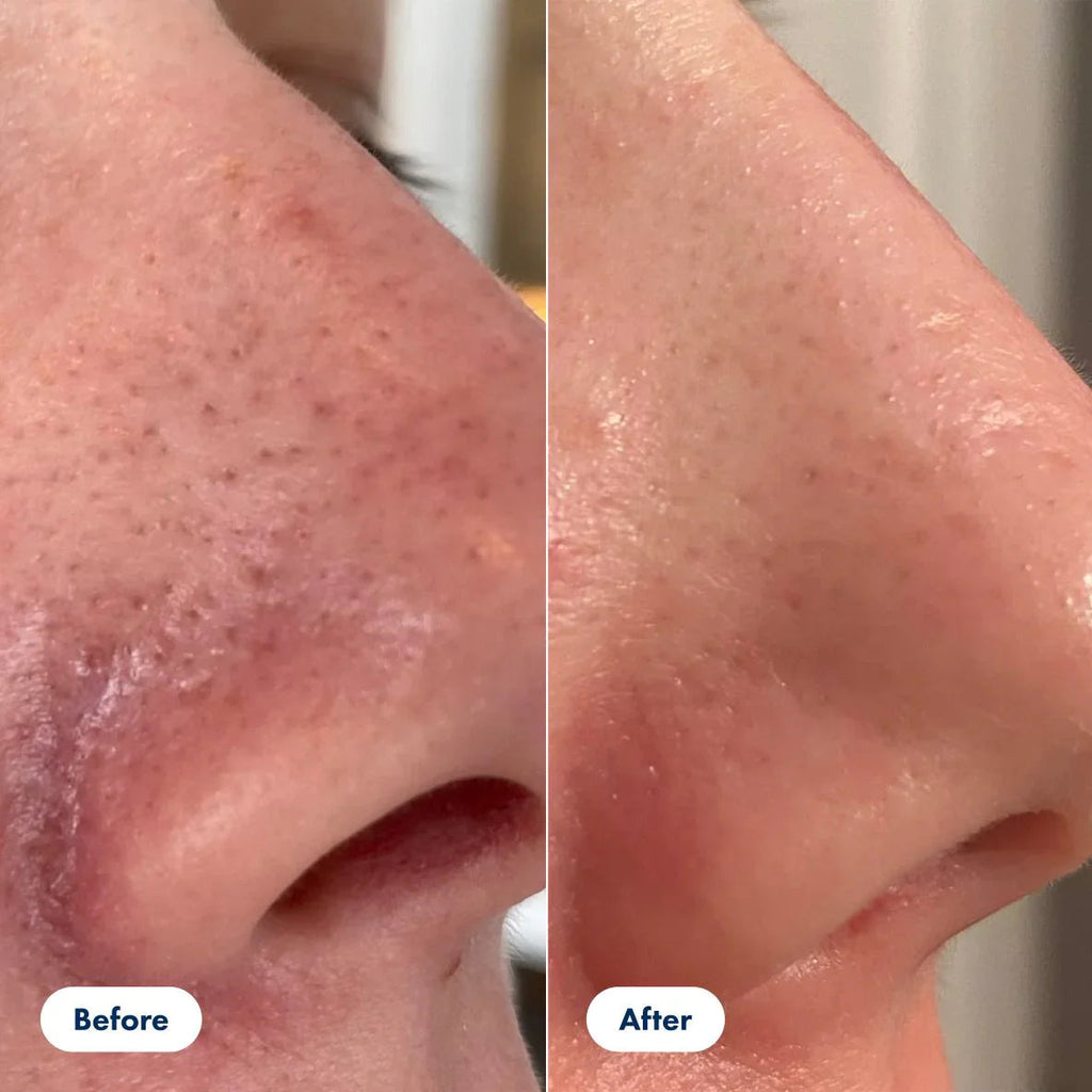 SilkVeil Radiance Serum | Entdecken Sie seidig glatte Haut, die Ihr Selbstvertrauen sofort zum Strahlen bringt | elesira