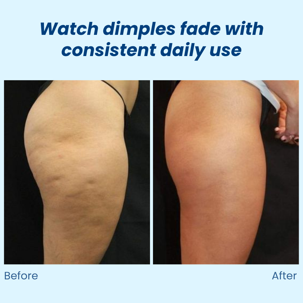 VividSculpt | Reveal Silky, Sculpted Skin That Boosts Your Confidence Every Day | elesira