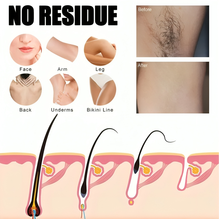 SilkSculpt Hair Removal Spray | Reveal Silky, Irritation-Free Skin You’ll Love to Touch | elesira