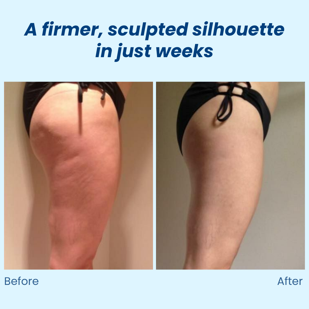 VividSculpt | Reveal Silky, Sculpted Skin That Boosts Your Confidence Every Day | elesira