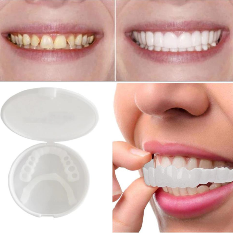 SmileShine | Instantly Own Every Room with a Stunning, Natural Glow | elesira