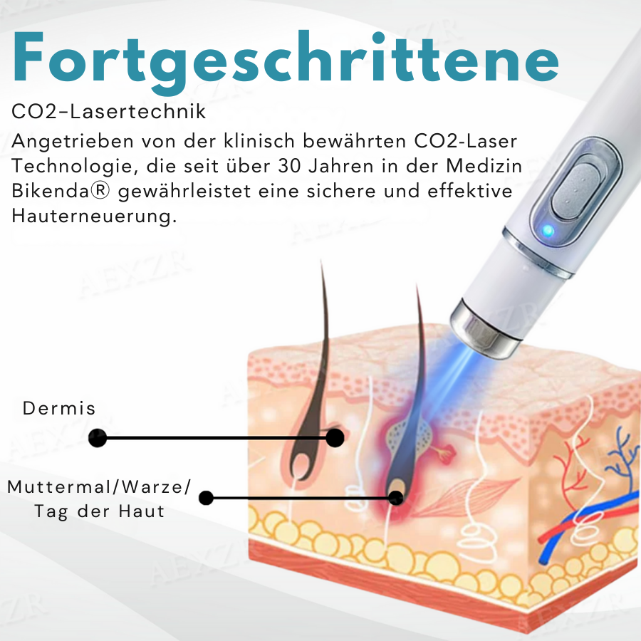 Skin Rejuvenation Pen - Accurate Skin Correction - Non-Invasive Plasma Technology | elesira