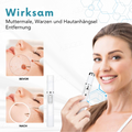 Skin Rejuvenation Pen - Accurate Skin Correction - Non-Invasive Plasma Technology | elesira