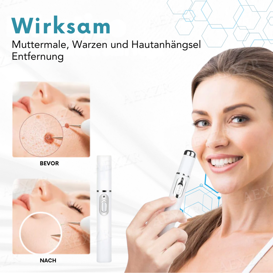 Skin Rejuvenation Pen - Accurate Skin Correction - Non-Invasive Plasma Technology | elesira