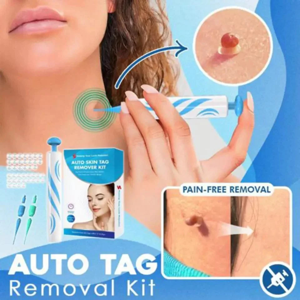 Conjunto para remover sinais cutâneos - Recupere facilmente uma pele suave