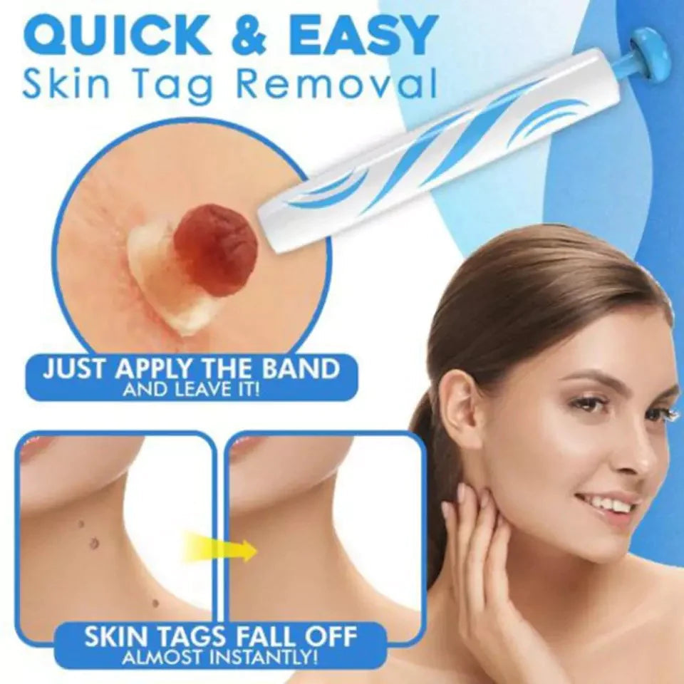 Conjunto para remover sinais cutâneos - Recupere facilmente uma pele suave