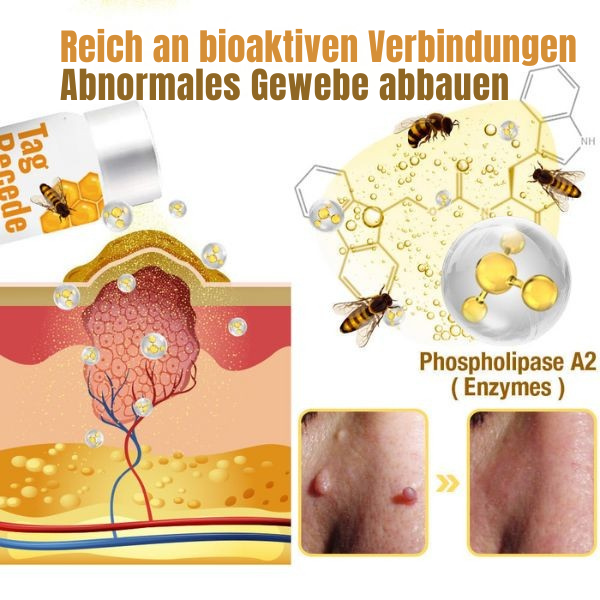 Wart Removal Spray with Bee Venom Formula - Pain-Free Solution | elesira