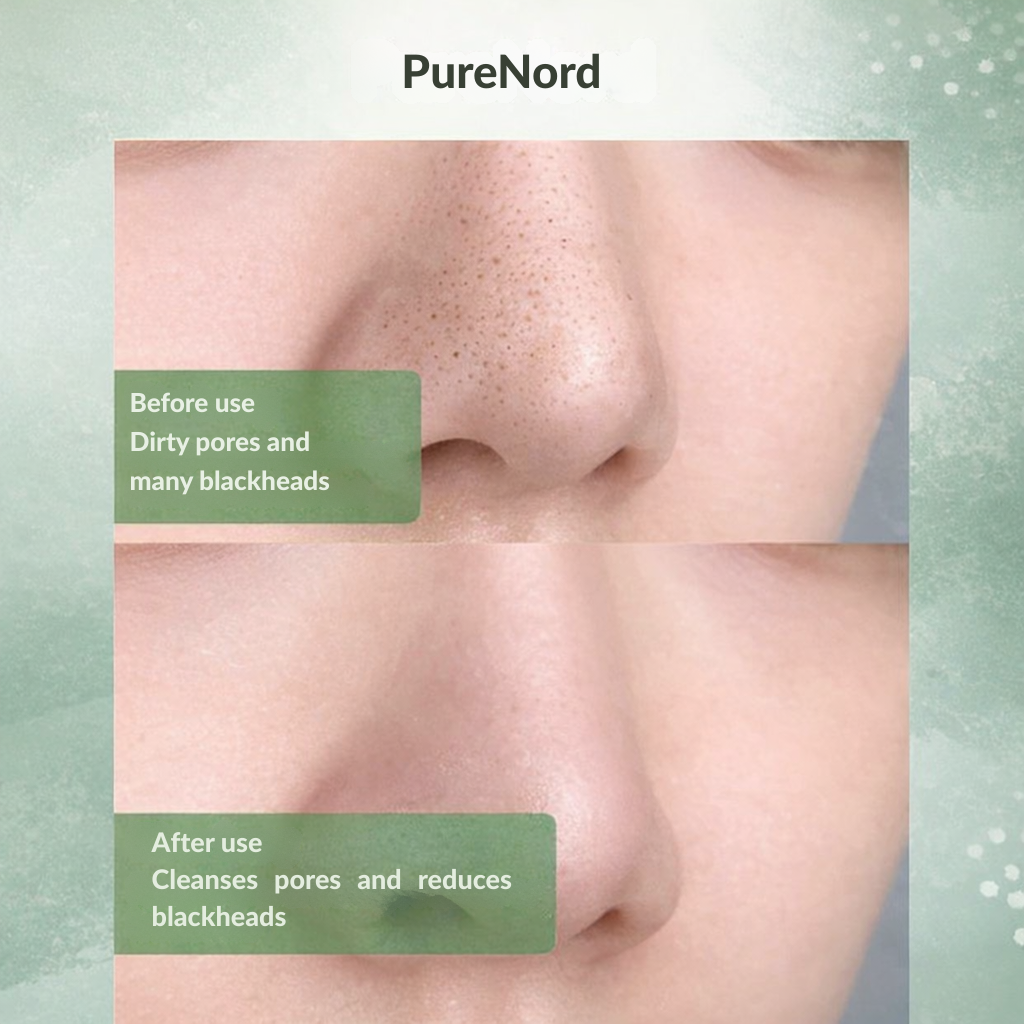 Nettoyant solide VitaDew | Révélez une peau nette et apaisée, éclatante toute la journée | elesira