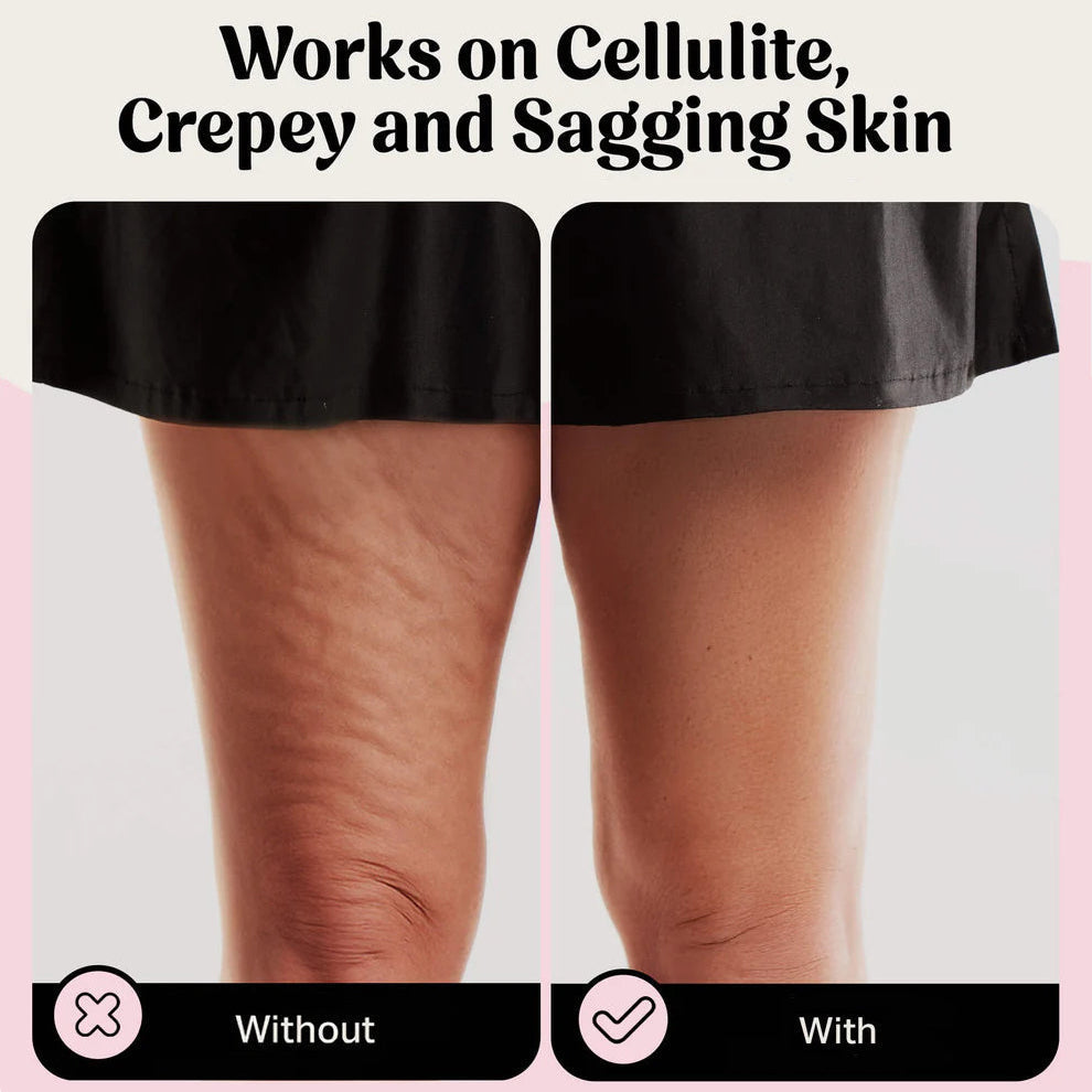 VellaShape Body Tape | Instantly Lift and Smooth Your Curves for Unstoppable Confidence | elesira