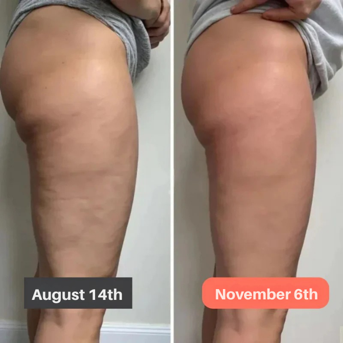 Leggings VitaSculpt | Sprigiona la tua forza e valorizza ogni curva per gambe da sfoggiare con orgoglio | elesira