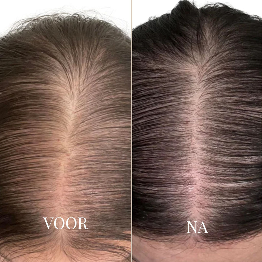 SilqueMist | Elimina al instante las canas y vive cada momento con una confianza impecable en tu cabello | elesira