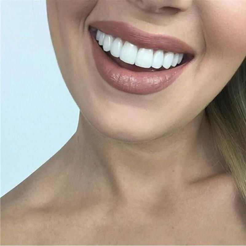 SmileShine | Instantly Own Every Room with a Stunning, Natural Glow | elesira
