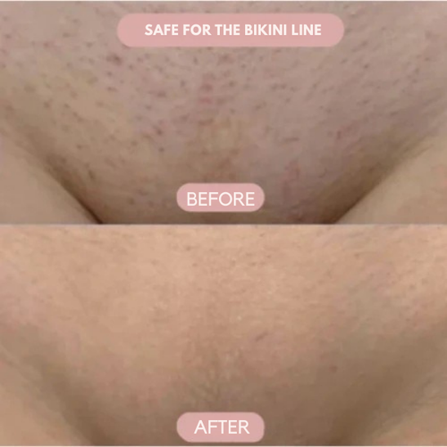 VelvetGlide | Enjoy Silky, Bump-Free Skin Without a Single Cut or Irritation | elesira